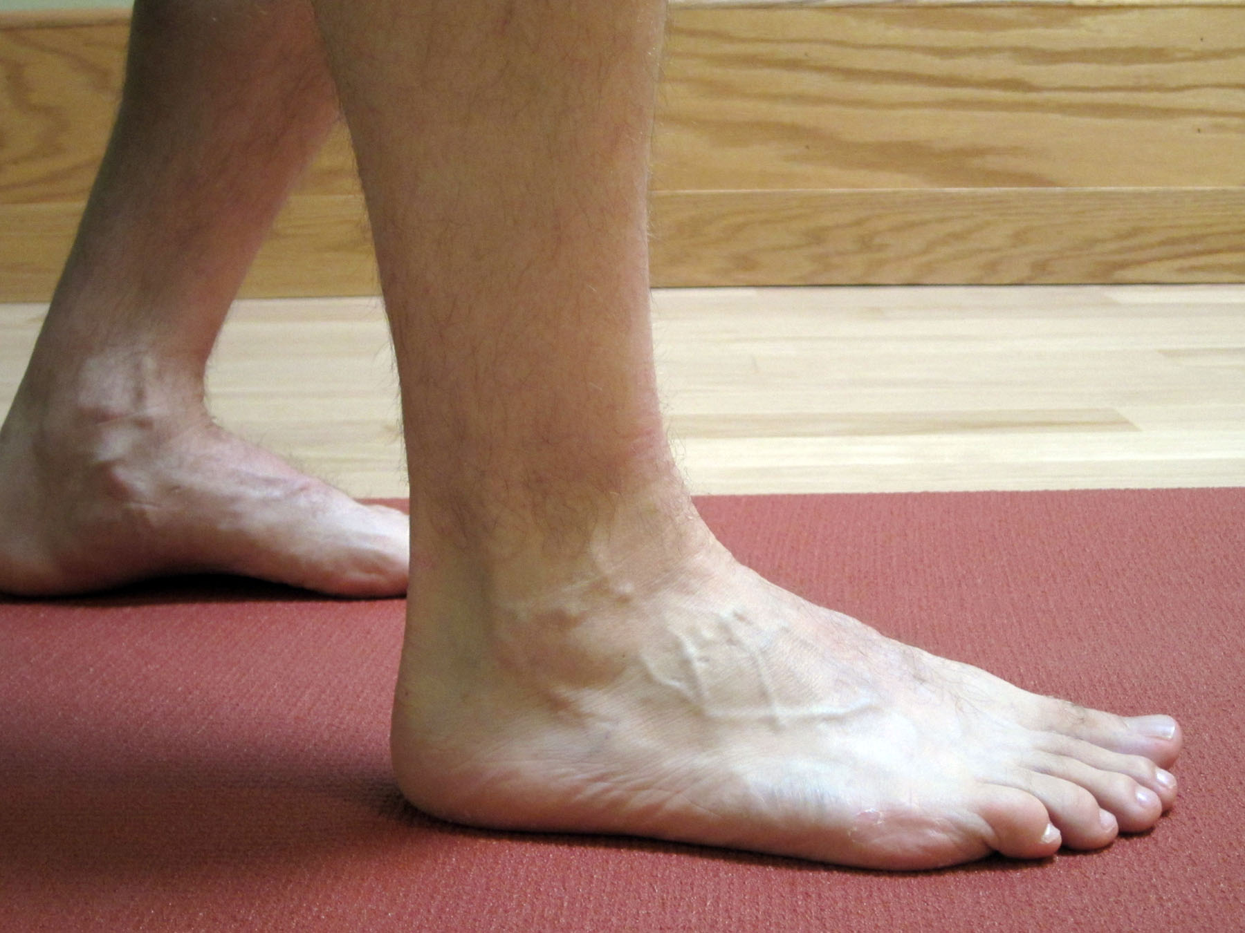 Повреждения голеностопа ноги