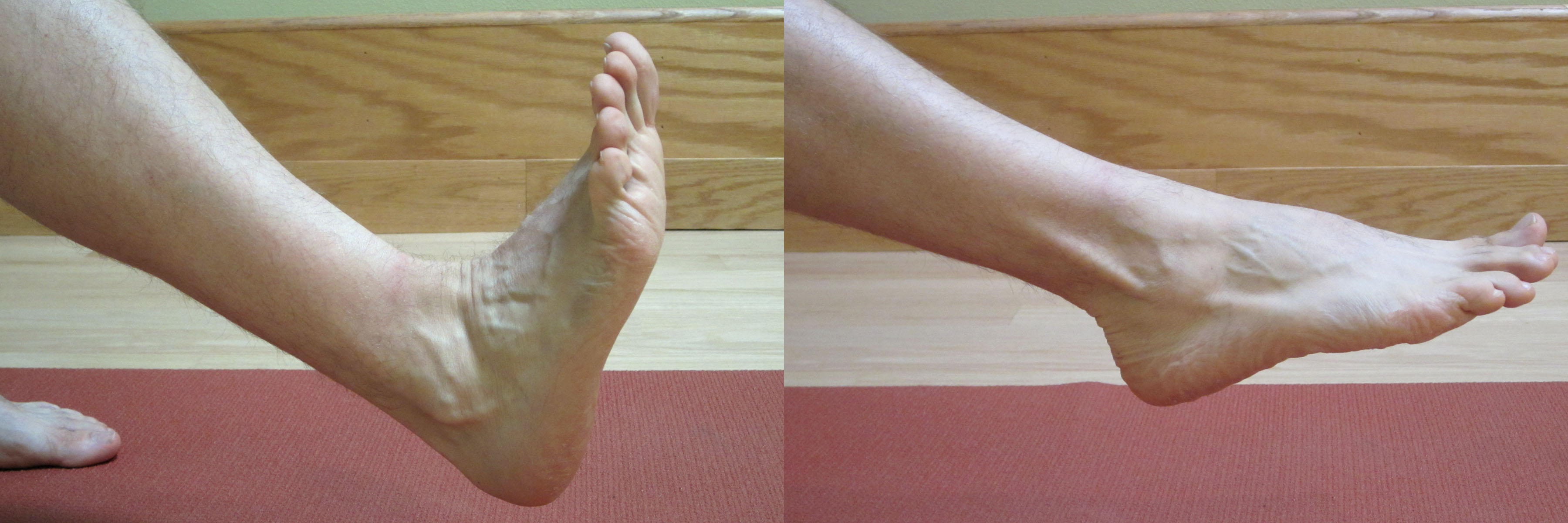 New Ankle Strengthening / Sprained Ankle Rehab Exercise