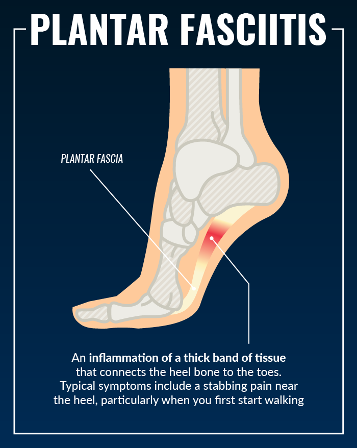 treatment for plantar fasciitis foot pain